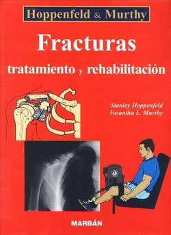 Fracturas, tratamiento y rehabilitación, Hoppenfeld & Murthy